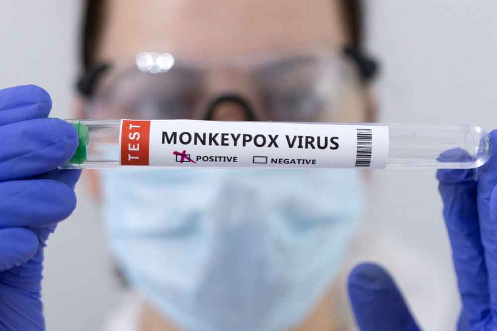 What is monkeypox and how is it transmitted? Qatar Health Ministry explains